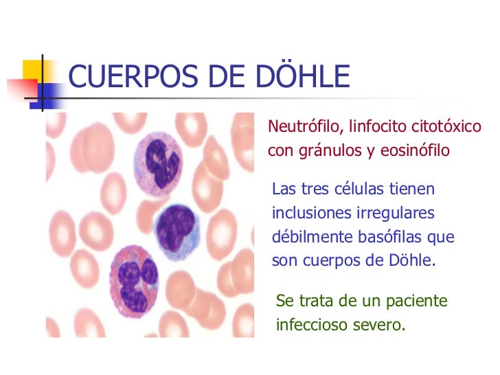 7 alteraciones de leucocitos 7 alteraciones de leucocitos
