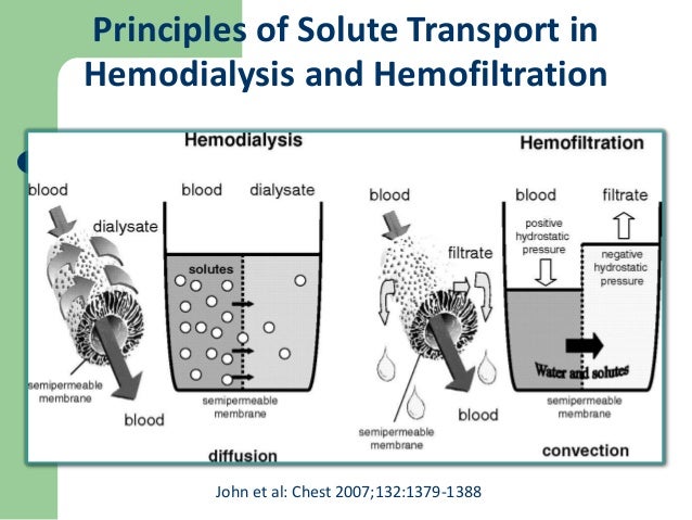 Dialysis pneumonia treatment dialysis mater health center