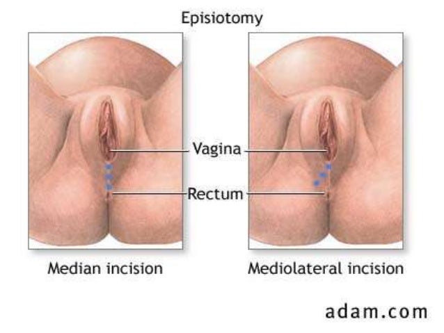 My Vagina Hurts After Sex 3