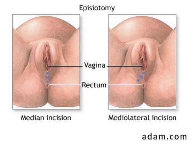 Anal Sex After C Section 7