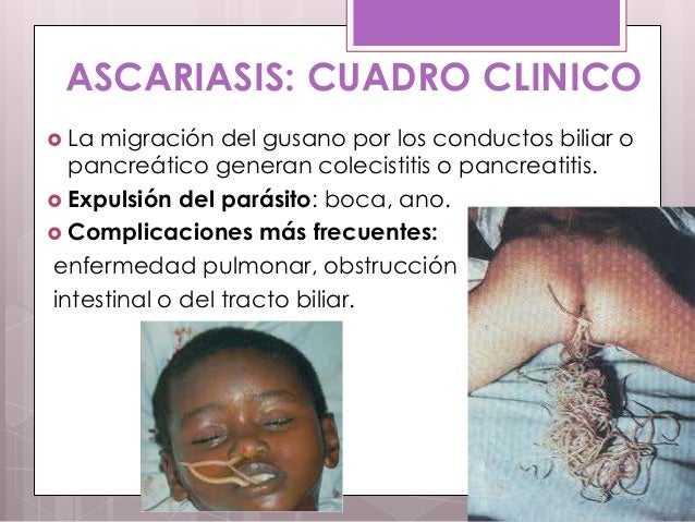 Anti el parásito las revocaciones