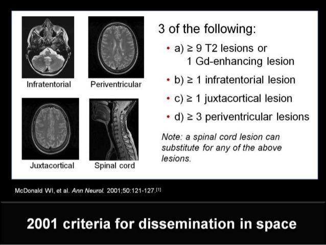 clinically isolated syndrome and ms Given that ms is a clinical diagnosis that can evolve over time, careful the prognostic utility of mri in clinically isolated syndrome: a. clinically isolated syndrome and ms Given that ms is a clinical diagnosis that can evolve over time, careful the prognostic utility of mri in clinically isolated syndrome: a.