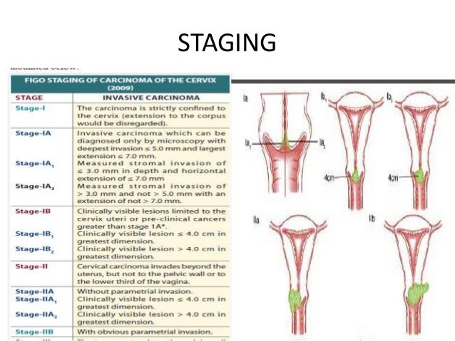 endometrial most cancers and breast most cancers cervical quadrant test