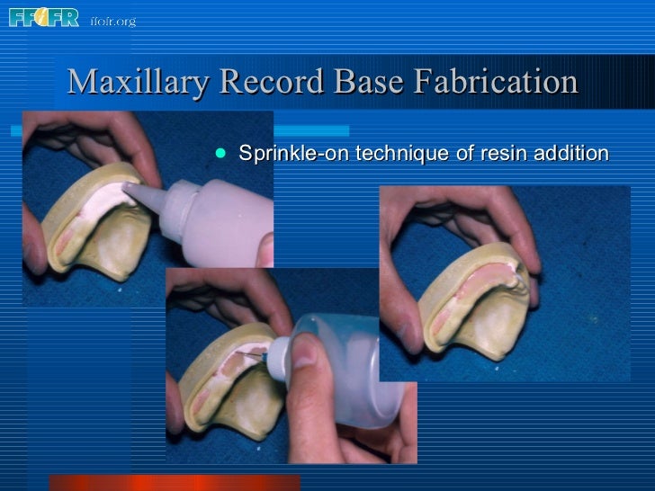 9.record base and wax rim fabrication