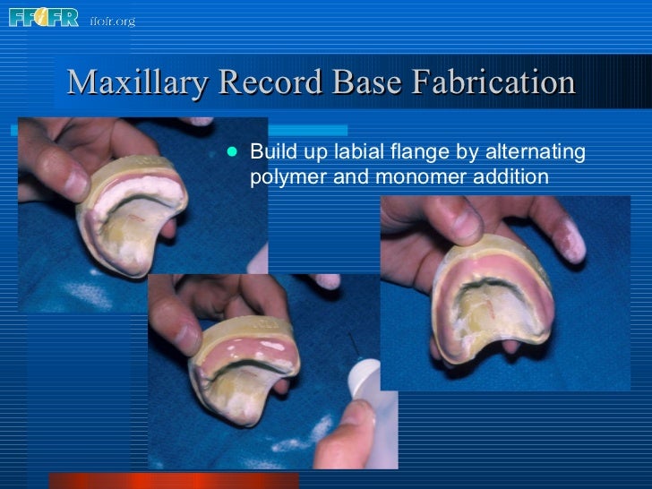 9.record base and wax rim fabrication