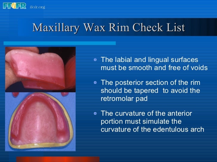 9.record base and wax rim fabrication