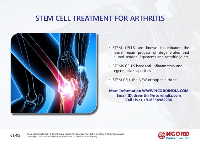 Stem Cell Treatment For Arthritis