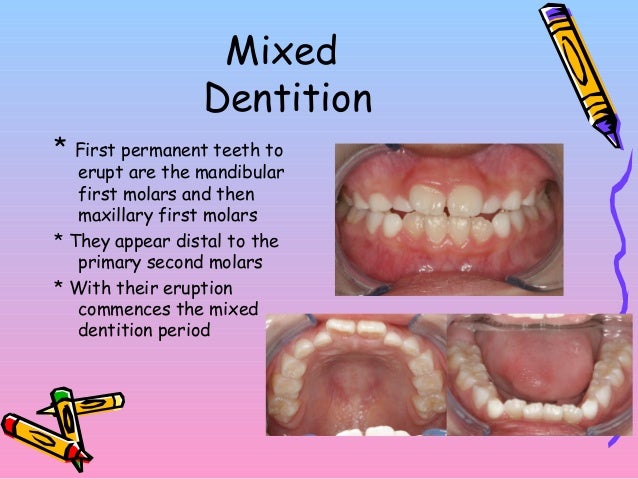 Primary Dentition and Eruption