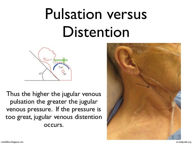 ABCDs of Chest Pain