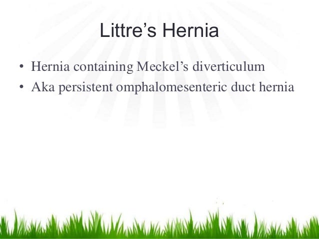 mesothelioma law company plus