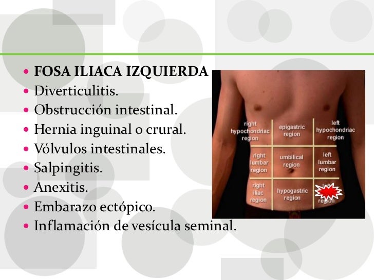 Abdomen agudo