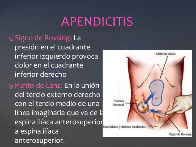 Sheynyy la osteocondrosis curar vitafonom