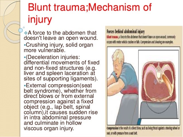 Blunt injury abdomen dissertation
