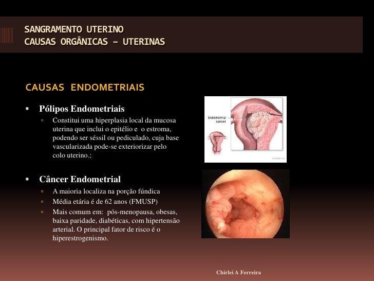 Abordagem A Paciente Com Sangramento Chirlei