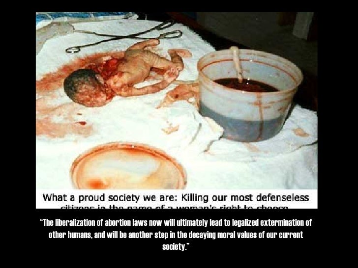 Necessities of abortion