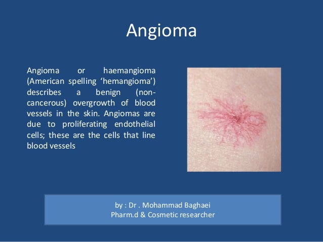 A brief review Skin Cysts, Lumps, and Bumps