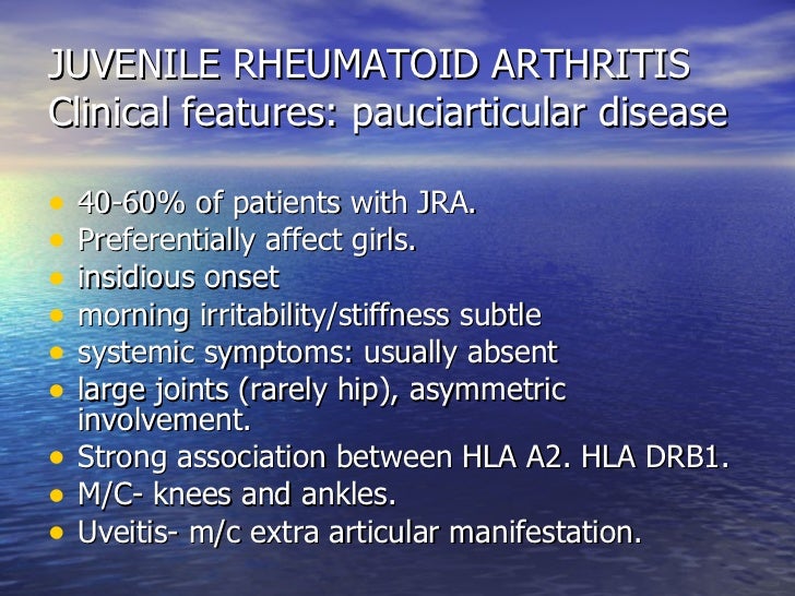 Overview of the systemic and nonarticular manifestations of rheumatoid arthritis image