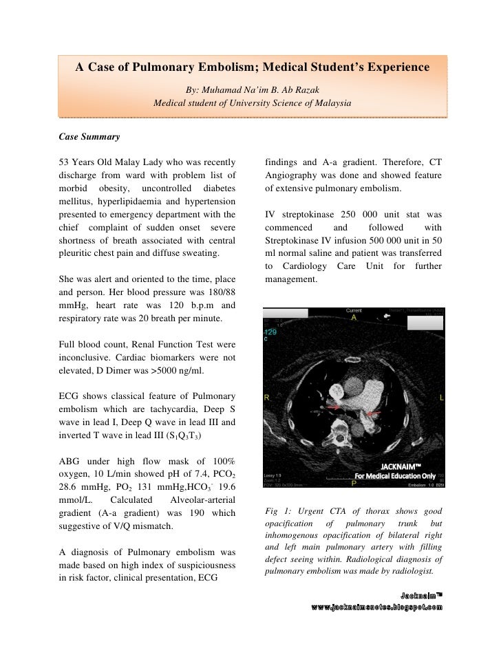 case study pulmonary embolism case study pulmonary embolism