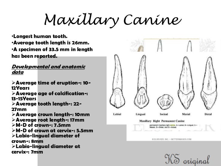 Access cavity preparation for maxillary canines