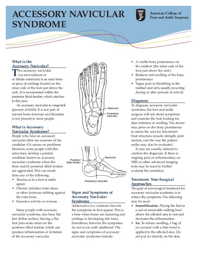 Accessory navicular syndrome