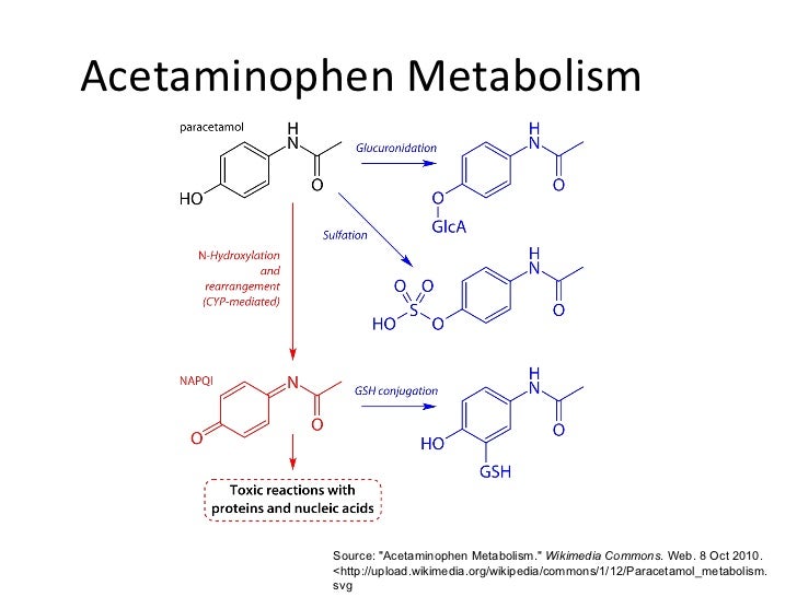 Acetaminophen (APAP) Toxicity Clinical Cases, Diagnosis, Pathology,