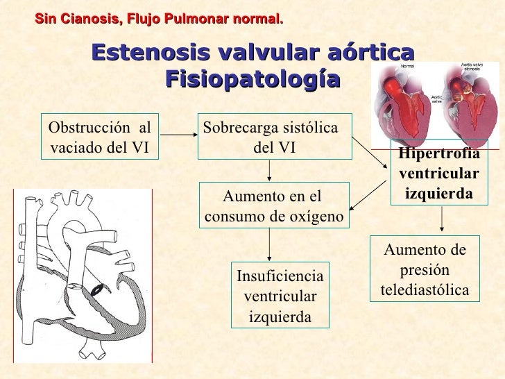 Como mejorar la forma del pecho sin operaciones