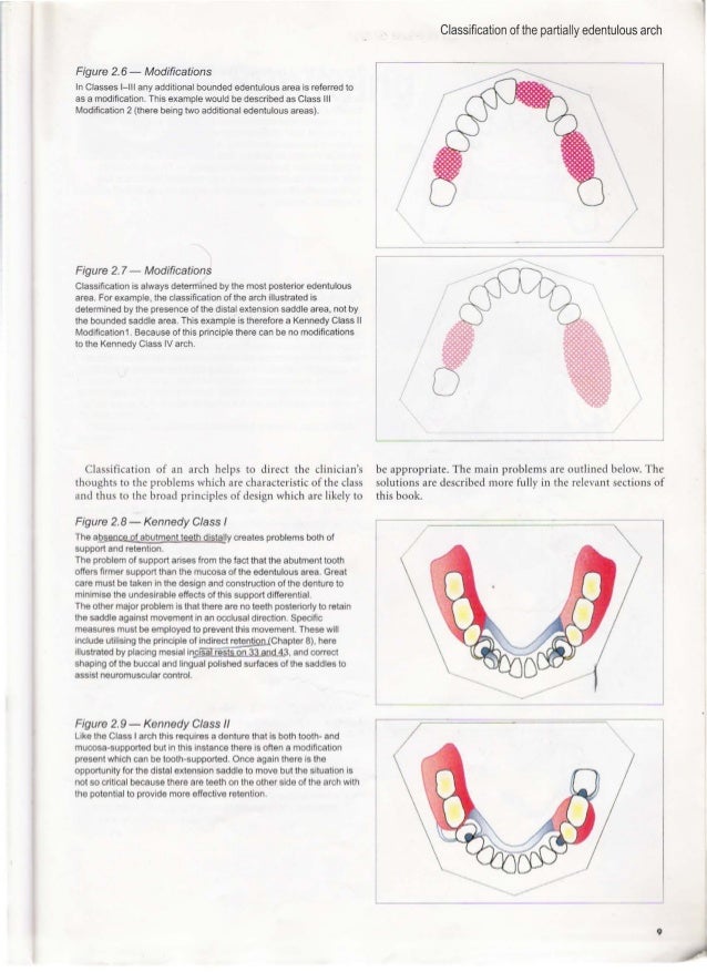 Modification De La Rã Munã Ration a unilateral modification is used for a clinical guide to Modification De La Rã Munã Ration a unilateral modification is used for a clinical guide to