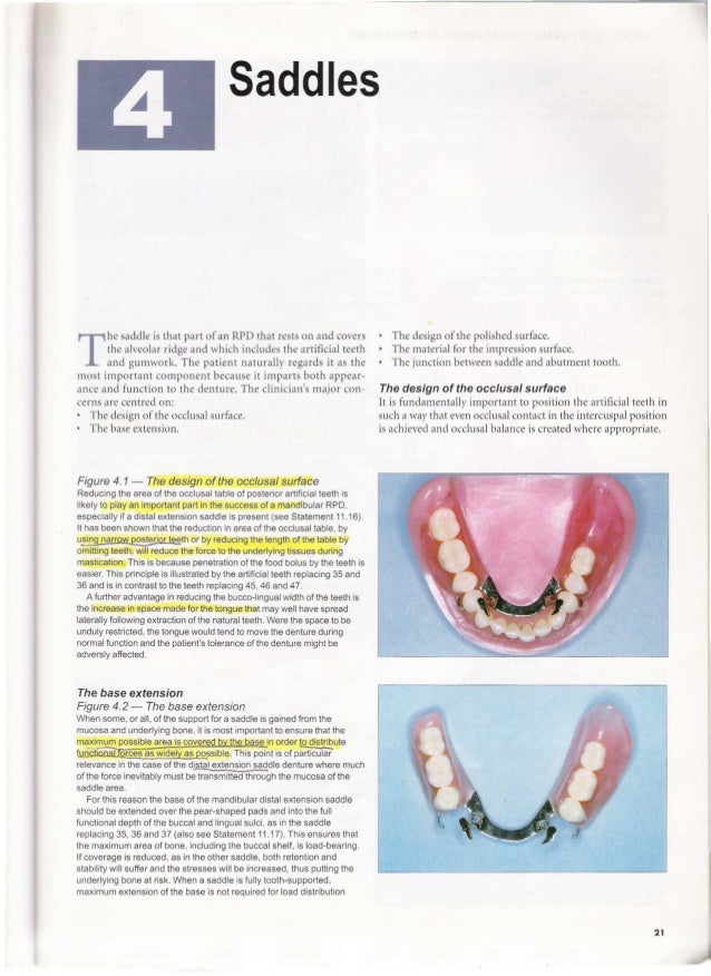 A clinical guide_to_removable_partial_denture_design