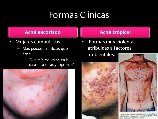 Remédios de gente de descarte de lugares na cara