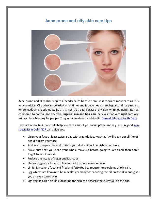 acne-prone-and-oily-skin-care-tips-1-638.jpg?cb=1458306018