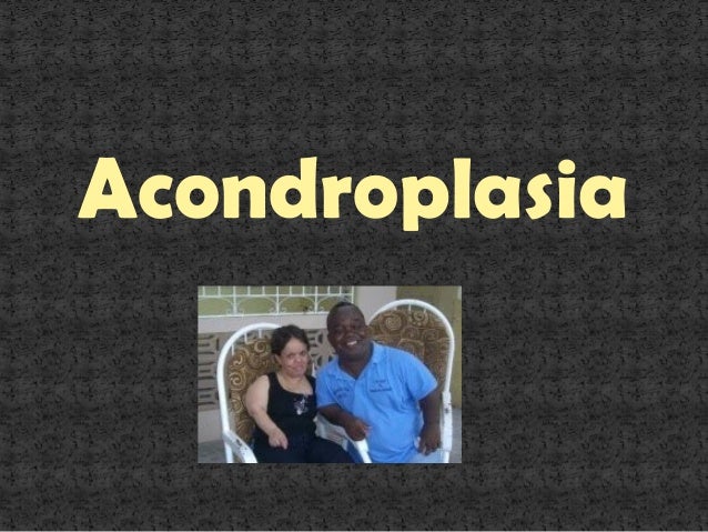 Acondroplasia