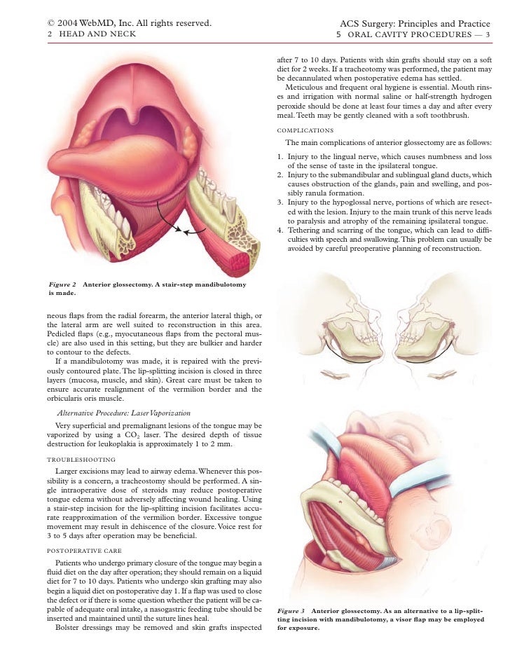 Acs0205 Oral Cavity Procedures