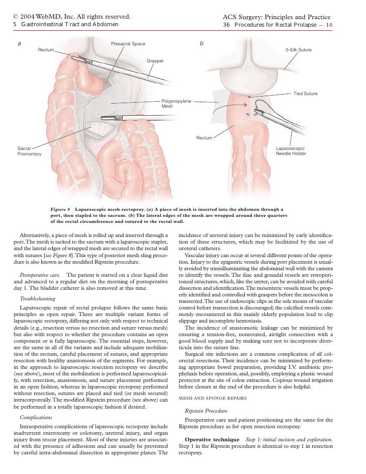 Levitra Rectal