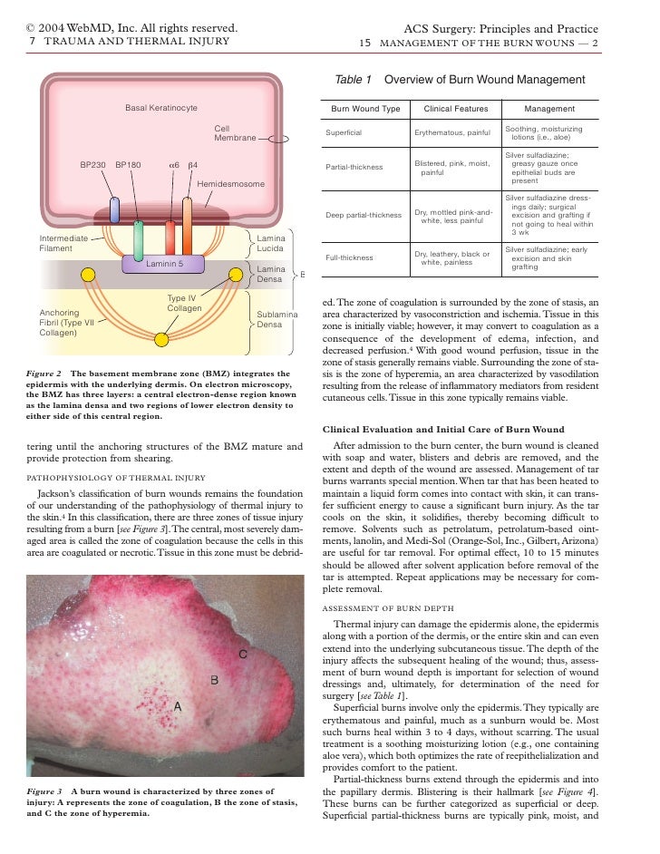 Acs0715 Management Of The Burn Wound