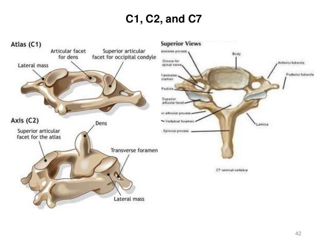 Activity 3 - Axial Skeleton