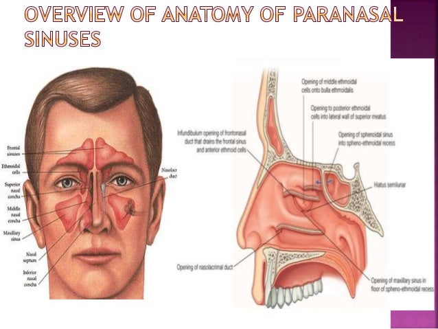 Persistent sinusitis investigations sinus cavity dryness
