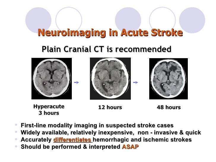 acupuncture stroke protocol recuperation after stroke