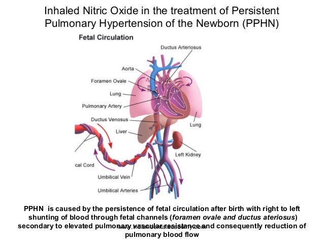 Viagra Helps With Pulmonary Hypertension