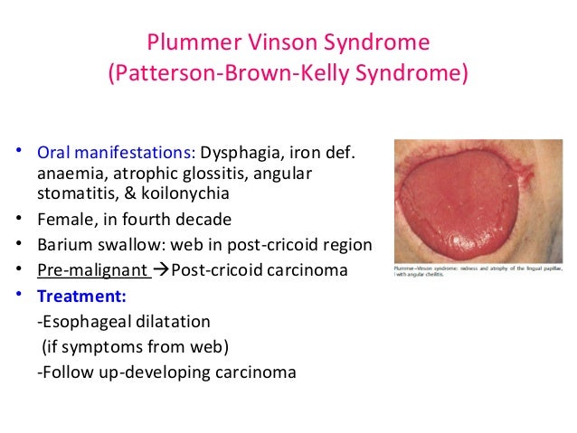 Sinus cyst problems sinus contamination with nose blood