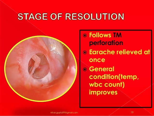sinus cyst draining plucking nostril hair sinus contamination