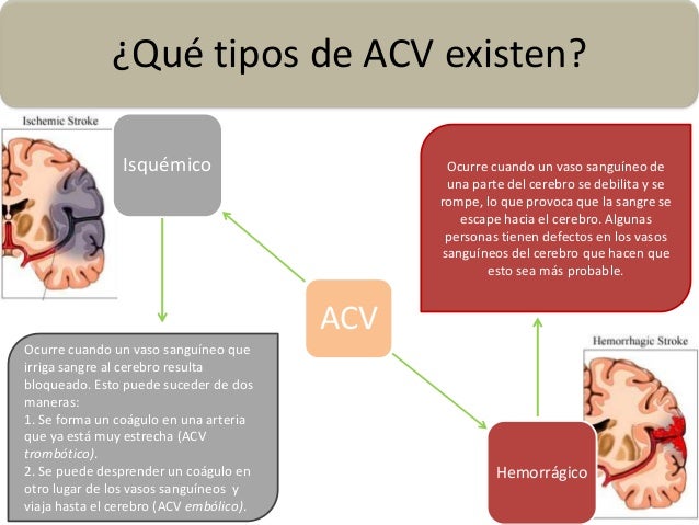 Resultado de imagen de causas afasia