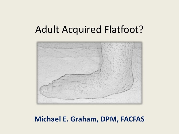 Acquired Flat Feet