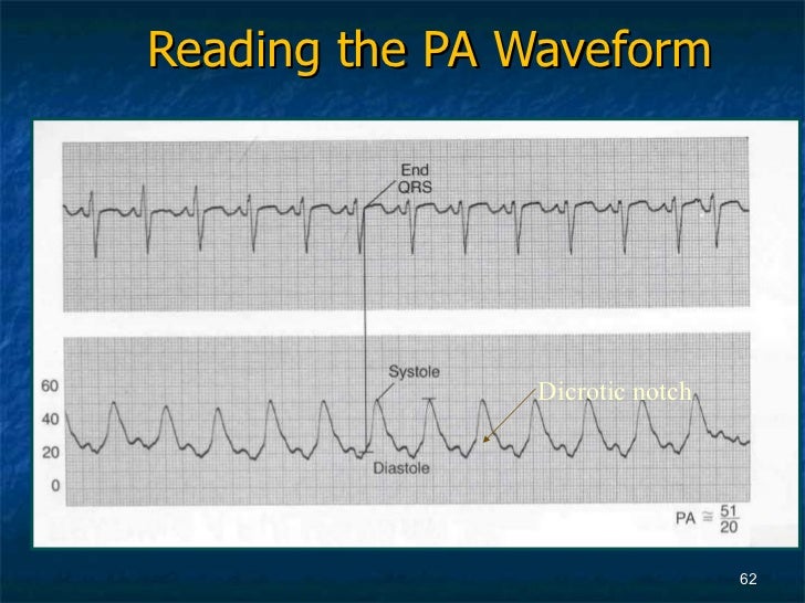 Advanced Hemodynamics