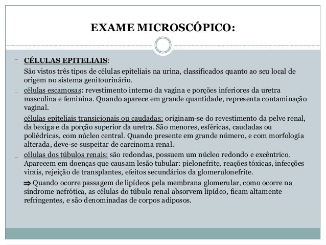 Celulas epiteliais numerosas no exame de urina