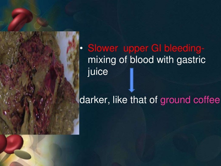 Aetiology of upper gi bleed