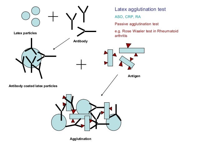 WEIL FELIX REACTION IN Q FEVER - Wroc?awski Informator Internetowy