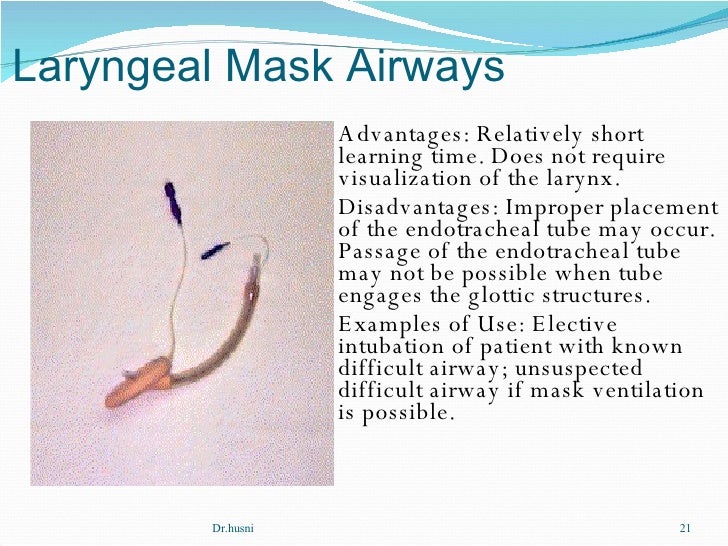Airway Manegement