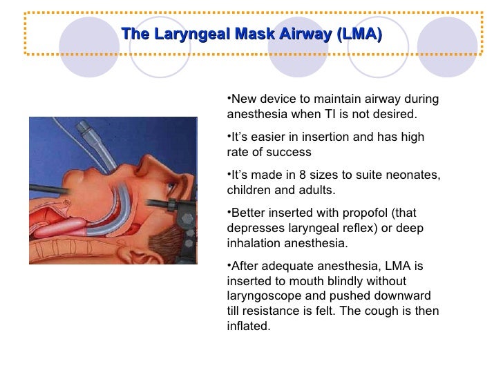 Airway Management