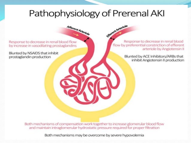 Kidney transplant keyhole surgery kidney problems dry mouth