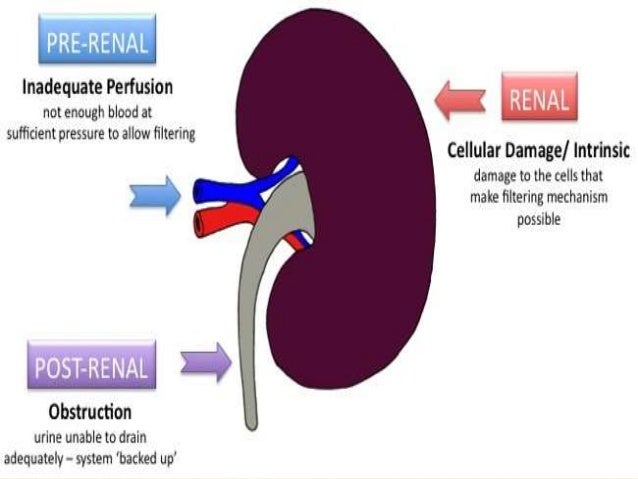 medullary cystic kidney disease x ray
